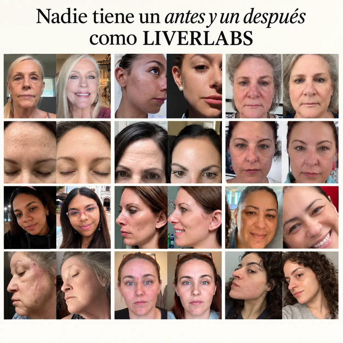 El Sistema Completo para la Piel de Mujeres Maduras